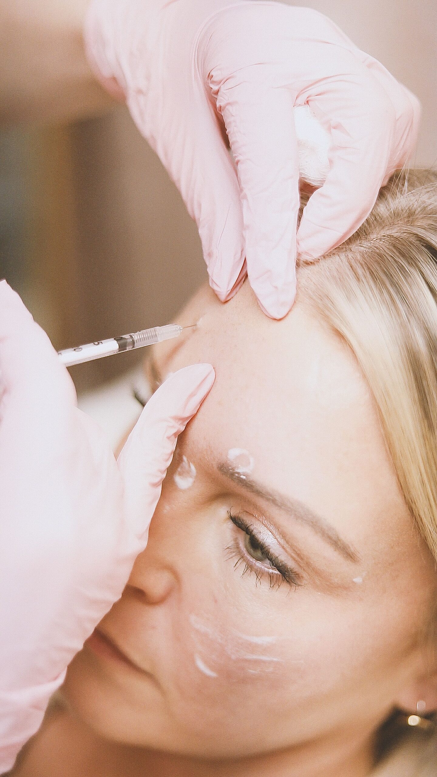 Botox treatment at Forever Young Complete Healthcare